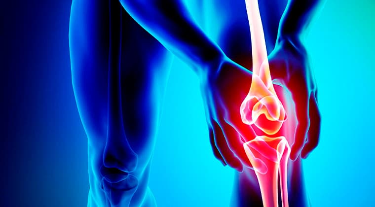 Artrosis (Osteoartritis)